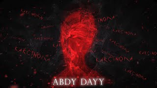 Abdy Dayy - Karcinoma